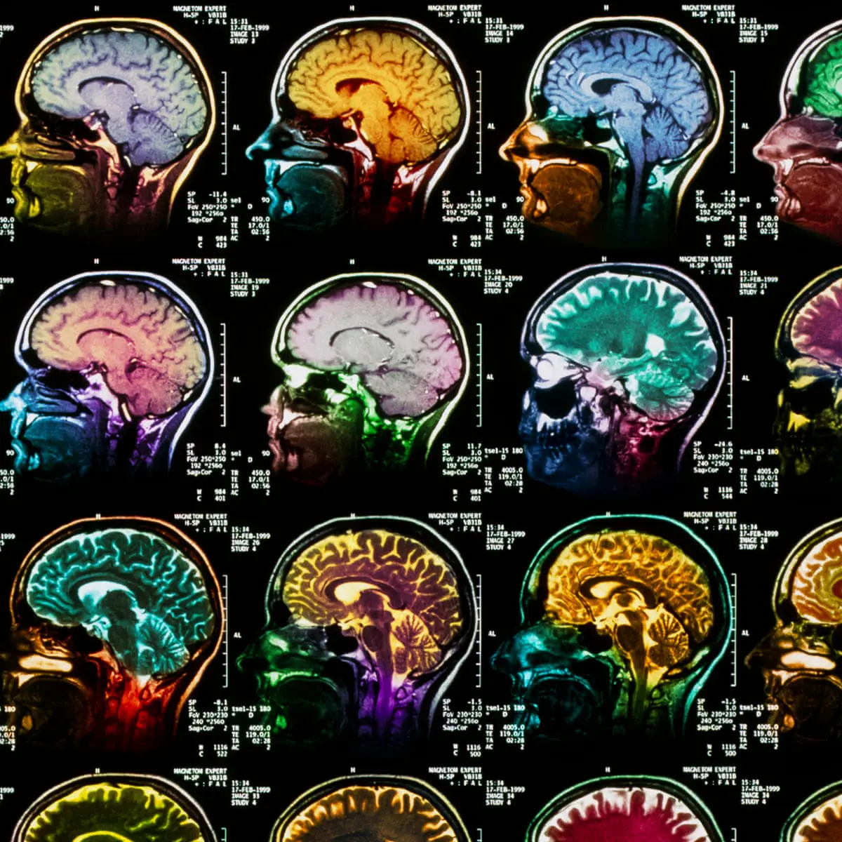 brainscan_guardian